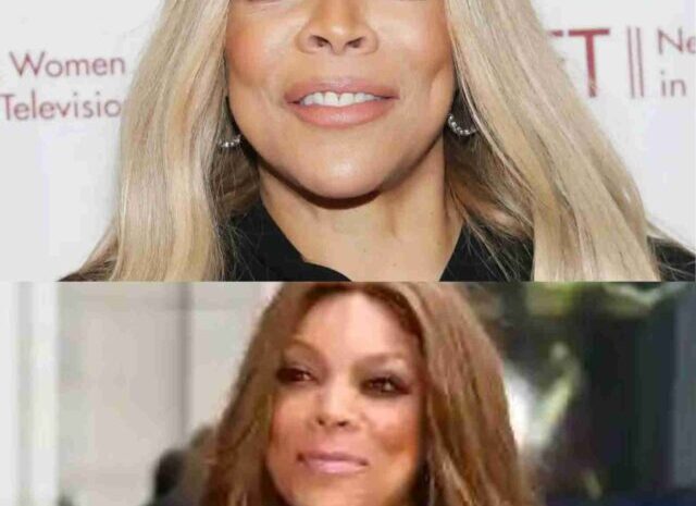 Has Wendy Williams undergone plastic surgery?